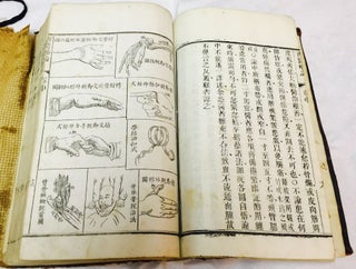 Xi yi lue lun [= First Lines of the Practice of Surgery in the West]