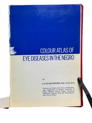 Colour Atlas of Eye Diseases in the Negro
