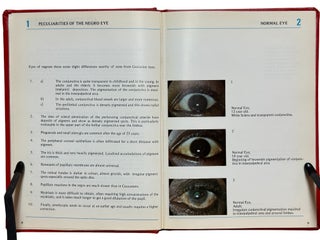 Colour Atlas of Eye Diseases in the Negro