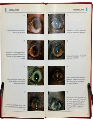 Colour Atlas of Eye Diseases in the Negro