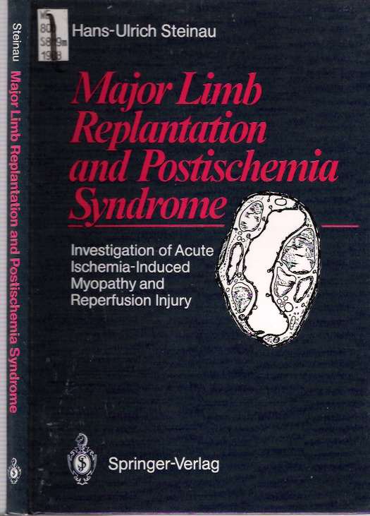 Item #4442 Major Limb Replantation and Postischemia Syndrome : Investigation of Acute Ischemia-Induced Myopathy and Reperfusion Injury. Hans-Ulrich Steinau.